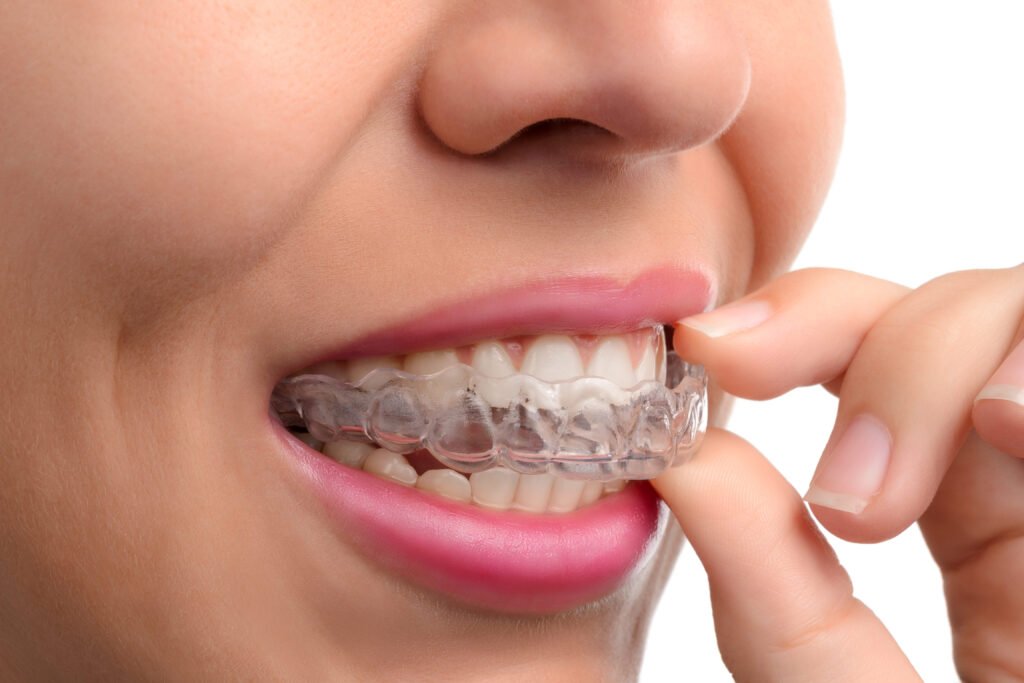Orthodontic and Invisalign