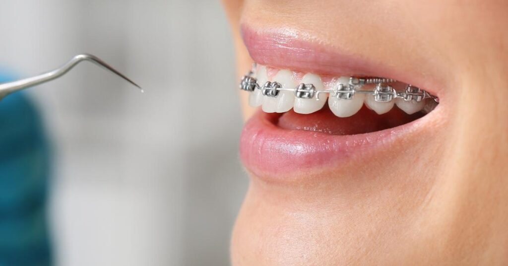 Orthodontic service in Richmond Hill