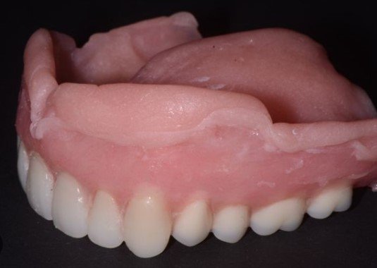 Liner for Dentures