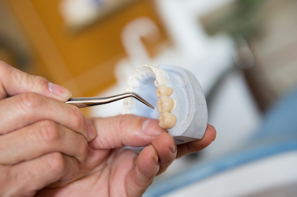 how long should dentures last