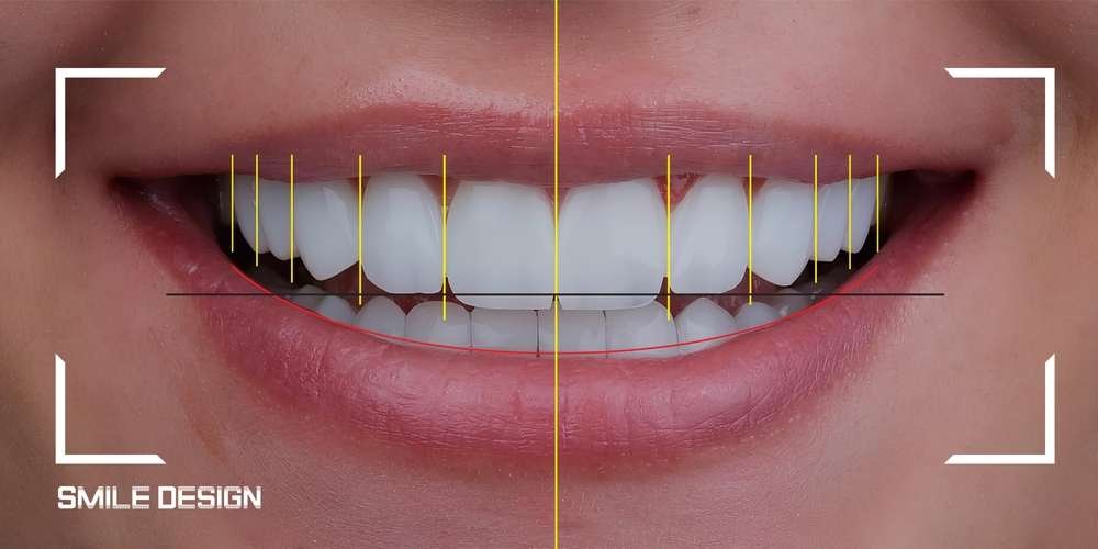 Complete Guide to Restorative Dentistry: Everything You Need to Know