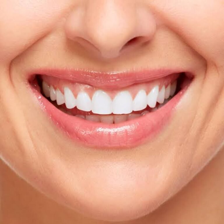 cosmetic dental filling