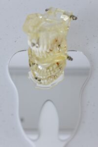 Child having a gentle dental check-up at a family dental clinic in Richmond Hill