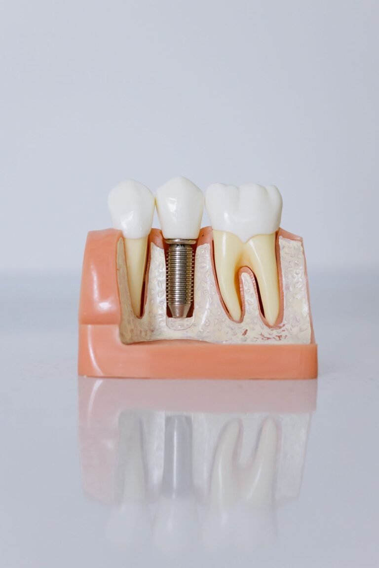 Dental model used to explain root canal treatment in Richmond Hill