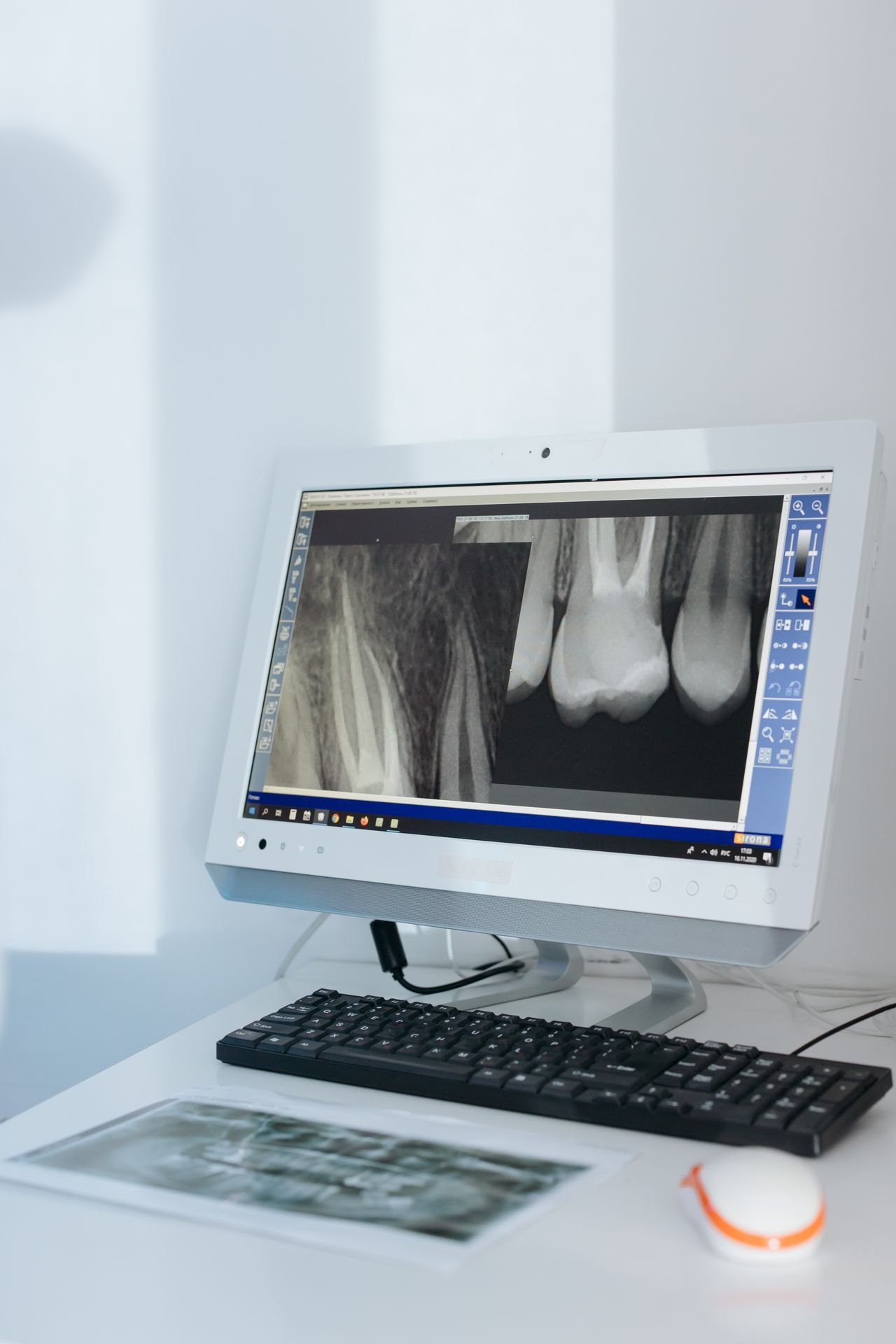 Dental x-ray displayed on a clinic monitor