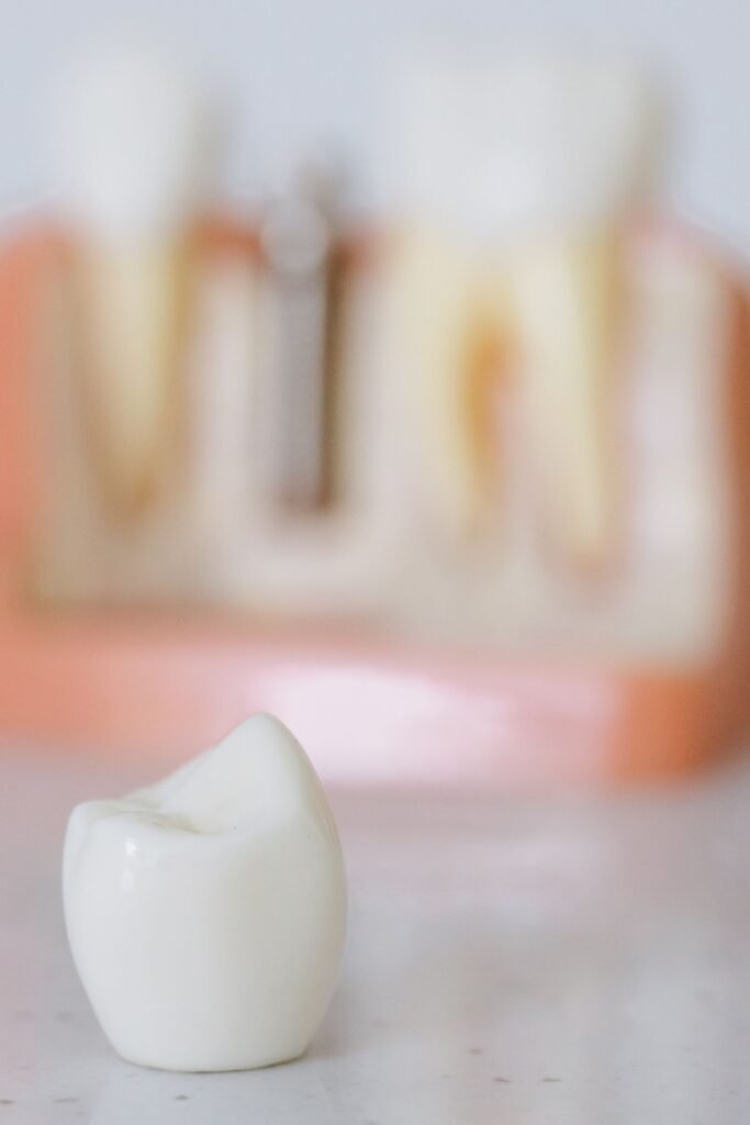 Close-up of a dental implant crown and abutment model