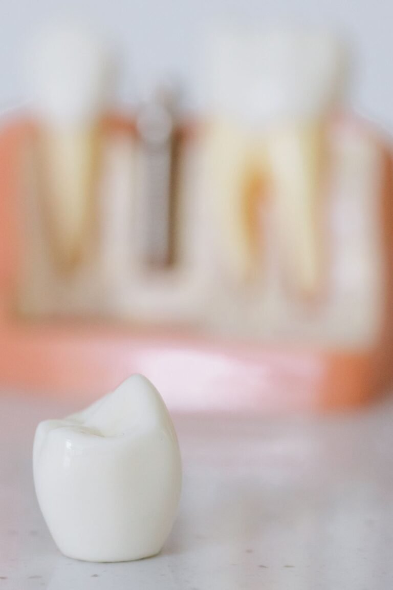 Close-up of a dental implant crown and abutment model
