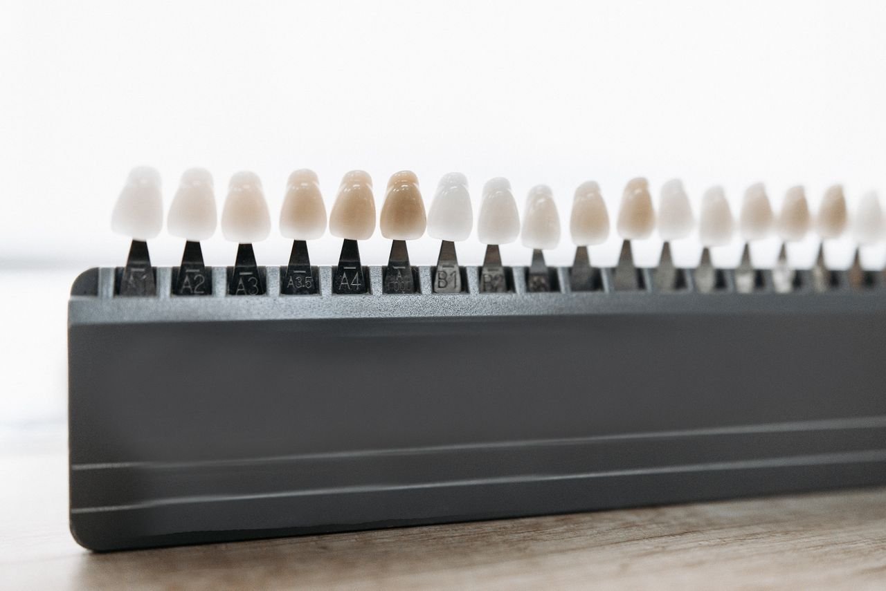 A row of porcelain veneers on display