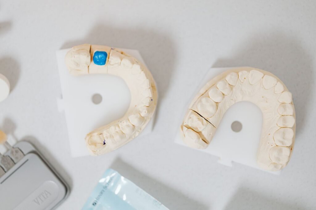 Dental crown and tooth models on a table at a Richmond Hill dental clinic