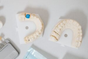 Dental crown and tooth models on a table at a Richmond Hill dental clinic