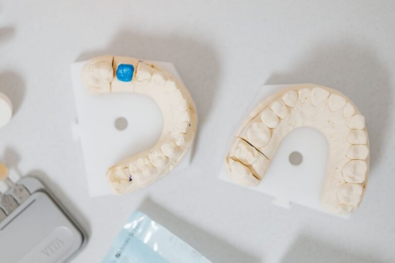 Dental crown and tooth models on a table at a Richmond Hill dental clinic