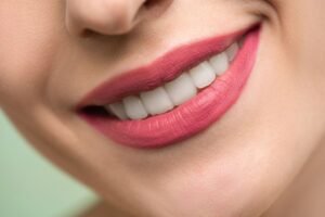 How Long Does Dental Bonding Last?